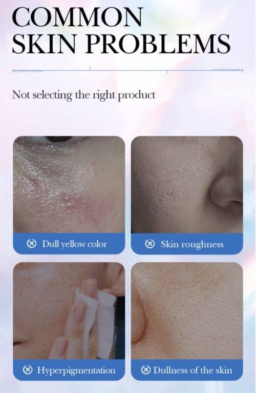SADOER Niacinamide Spot Removal Repair Facial Cream 50G - Image 3